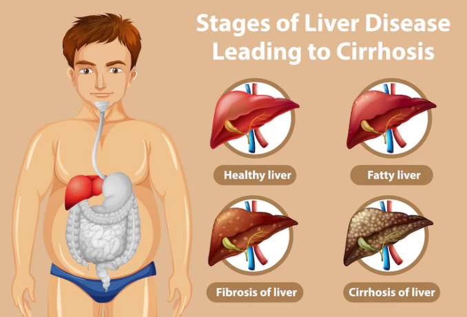 waspada-hepatitis-akut-pada-anak-berikut-ciri-cirinya